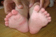 Chinese baby girl born with 12 fingers and 12 toes
