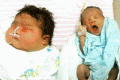 China largest baby delivered, 6.5 kilo